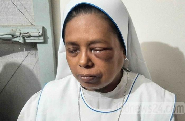 Atacan a una religiosa en Bangladés Atacan a una religiosa en Bangladés